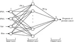 Prognosis of prostate cancer by artificial neural networks